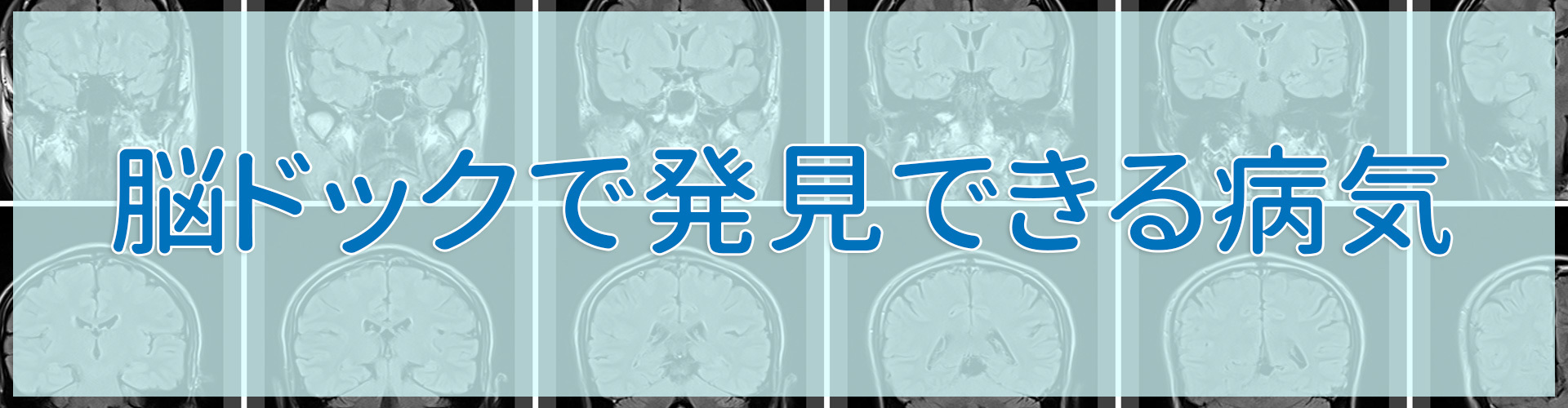 脳ドックで発見できる病気